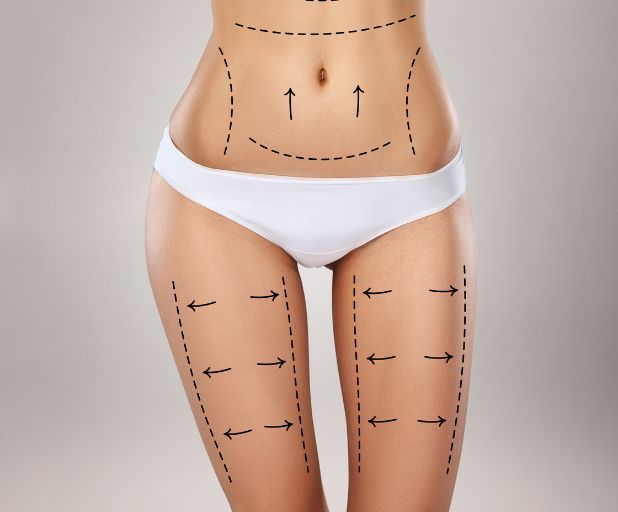 What Can Go Wrong With Liposuction & Tummy Tuck Procedures?