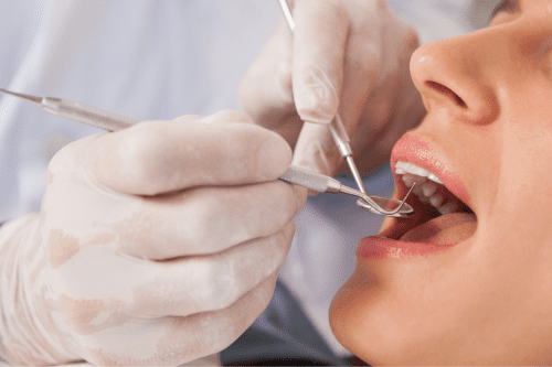 Rise in oral cancer deaths linked with the shortage of NHS dentists