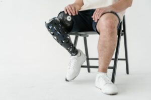 Claiming For A Personal Injury Following An Amputation