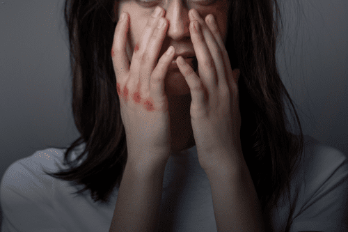 Domestic Abuse Injuries