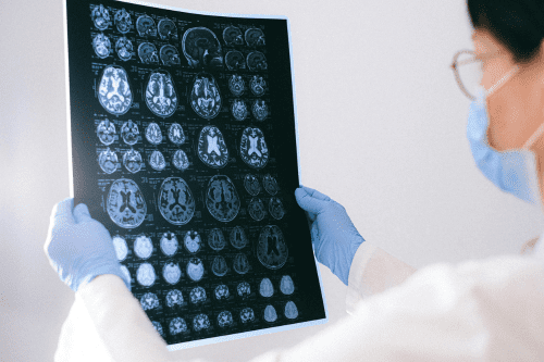 brain injury claim