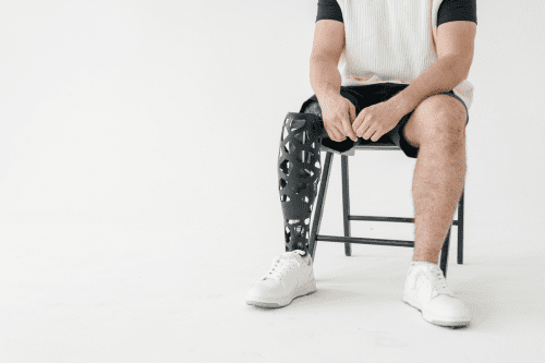 amputation claim solicitor