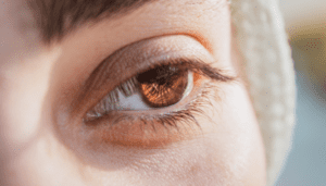 Time Limits for Eye Surgery Negligence Claims