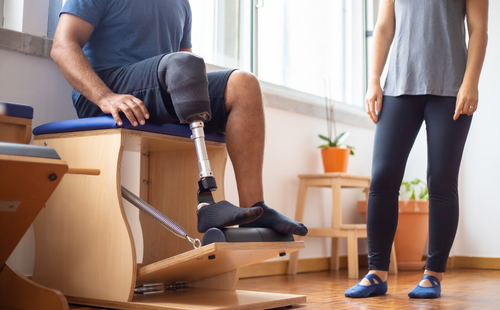 Amputation Claims UK- compensation-timelines-and your legal rights