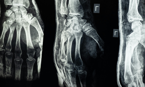 Personal Injury Claims A Step-by-Step Guide