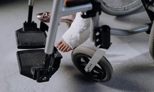 Personal Injury Claim Time Limits in England and Wales A Complete Breakdown